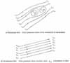 Total pressure for rotational and irrotational flows